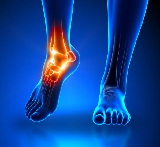 Rental and Sales of foot & Ankle injury products Port Alberni Vancouver Island Rental and Sales of foot & Ankle injury products Port Alberni Vancouver Island